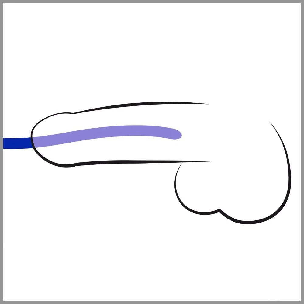 Prodotto per l'igiene intima Dilator 16.5 cm
