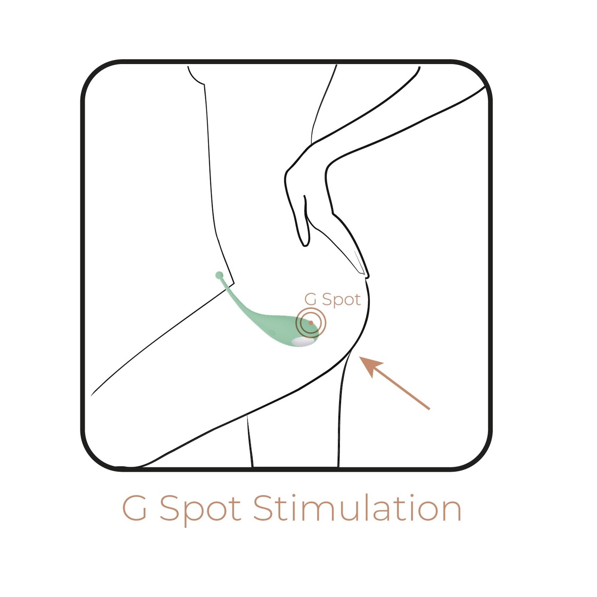Palpitation